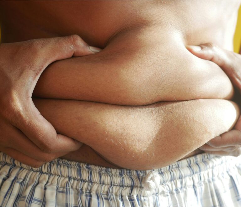 Excess Fat