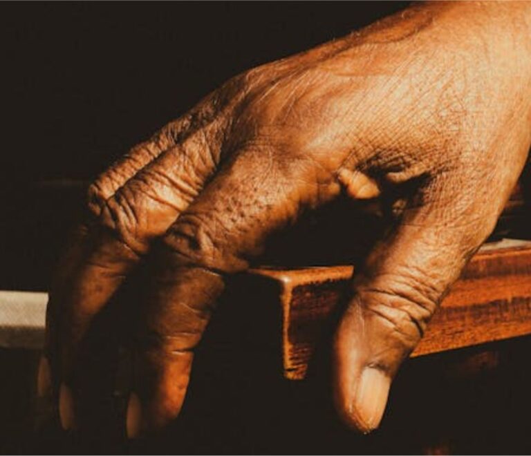 Hand ageing and Wrinkles
