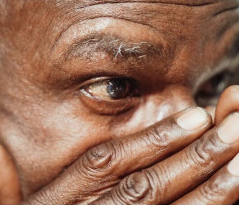 Skin Ageing